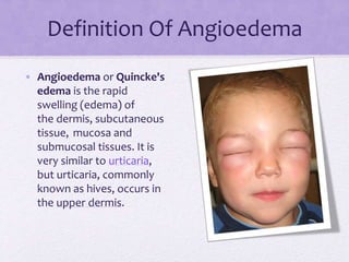 Definition Of Angioedema
• Angioedema or Quincke's
edema is the rapid
swelling (edema) of
the dermis, subcutaneous
tissue, mucosa and
submucosal tissues. It is
very similar to urticaria,
but urticaria, commonly
known as hives, occurs in
the upper dermis.
 