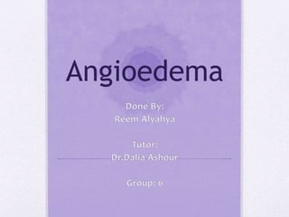 Angioedema
 