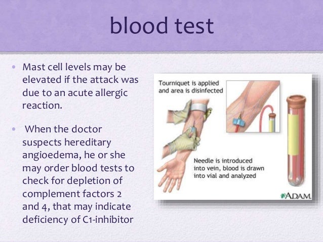 How do you treat angioedema?