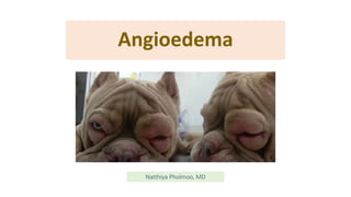 Angioedema
Natthiya Pholmoo, MD
 