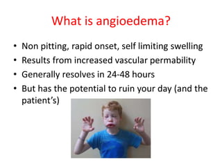 What is angioedema?
• Non pitting, rapid onset, self limiting swelling
• Results from increased vascular permability
• Generally resolves in 24-48 hours
• But has the potential to ruin your day (and the
patient’s)
 