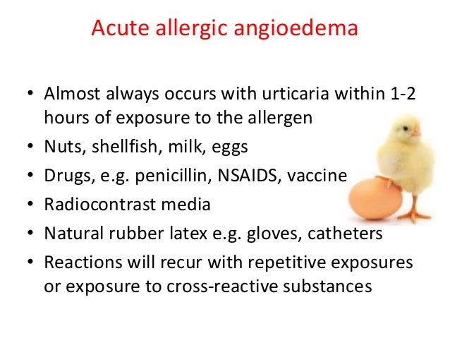 Angioedema