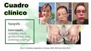 Cuadro
clínico
Topografía
Extremidades,
abdomen, tracto
genitourinario, cara,
orofaringe o laringe
Zafra H. Hereditary Angioedema: A Review. WMJ. 2022 Apr;121(1):48-53.
 