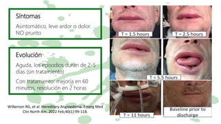 Síntomas
Asintomático, leve ardor o dolor.
NO prurito
Evolución
Aguda, los episodios duran de 2-5
días (sin tratamiento)
Con tratamiento: mejoría en 60
minutos, resolución en 2 horas
Wilkerson RG, et al. Hereditary Angioedema. Emerg Med
Clin North Am. 2022 Feb;40(1):99-118.
 