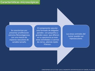 Características microscópicas
Se caracterizan por
presentar proliferación
estroma fibrocolagenosa
con una mezcla de
espacios vasculares de
variable tamaño
El componente vascular
esta formado de delgadas
paredes con pequeños a
grandes vasos que difieren
en su apariencia ya sean
estas estrelladas o cuernos
de ciervo, además tejido
fribroso.
Las áreas centrales del
tumor pueden ser
hipovasculares
CHRISTOPHER D.M FLETCHER (2013). DIAGNOSTIC HISTOPATHOLOGY OF TUMORS, 4ª edición
 