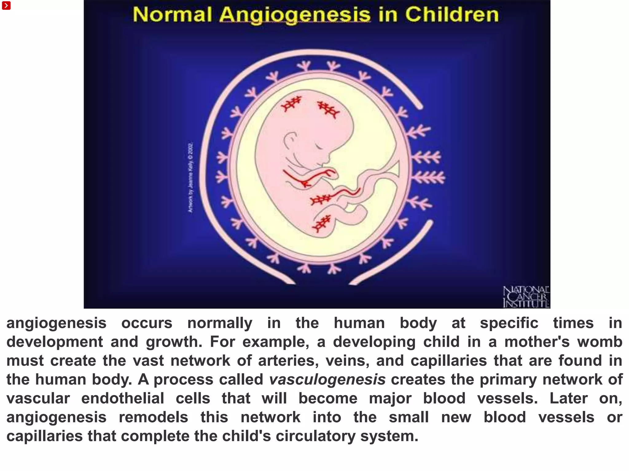 angiogenesis occurs normally in the human body at specific times in
development and growth. For example, a developing child in a mother's womb
must create the vast network of arteries, veins, and capillaries that are found in
the human body. A process called vasculogenesis creates the primary network of
vascular endothelial cells that will become major blood vessels. Later on,
angiogenesis remodels this network into the small new blood vessels or
capillaries that complete the child's circulatory system.
 
