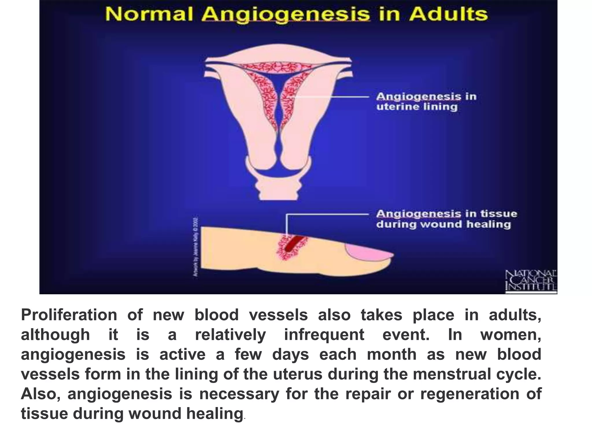Proliferation of new blood vessels also takes place in adults,
although it is a relatively infrequent event. In women,
angiogenesis is active a few days each month as new blood
vessels form in the lining of the uterus during the menstrual cycle.
Also, angiogenesis is necessary for the repair or regeneration of
tissue during wound healing.
 