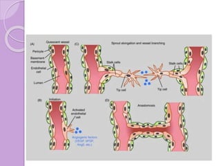 Angiogenesis | PPTX