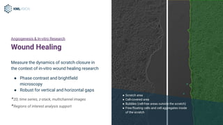 Angiogenesis Use Cases Solved with IKOSA | PDF