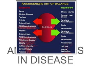 ANGIOGENESIS
IN DISEASE
 
