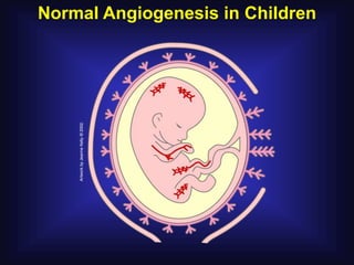 Normal Angiogenesis in Children
 