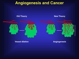 Angiogenesis and Cancer


 Old Theory       New Theory




Vessel dilation   Angiogenesis
 