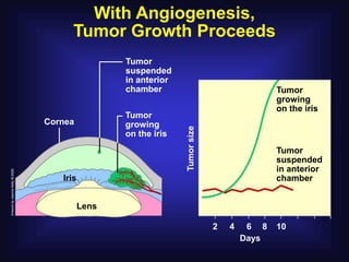 With Angiogenesis,
      Tumor Growth Proceeds
                 Tumor
                 suspended
                 in anterior
                 chamber                                   Tumor
                                                           growing
                                                           on the iris
                 Tumor
Cornea           growing




                               Tumor size
                 on the iris
                                                           Tumor
                                                           suspended
                                                           in anterior
   Iris                                                    chamber


          Lens

                                            2   4    6 8   10
                                                    Days
 