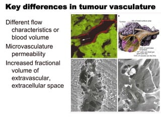 Key differences in tumour vasculature

Different flow
  characteristics or
  blood volume
Microvasculature
  permeability
Increased fractional
  volume of
  extravascular,
  extracellular space
 