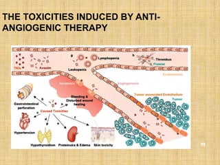 THE TOXICITIES INDUCED BY ANTI-
ANGIOGENIC THERAPY




                                  99
 