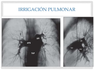 IRRIGACIÓN PULMONAR
 