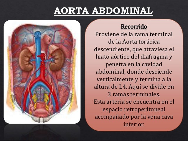 Angiografía Aorta Abdominal