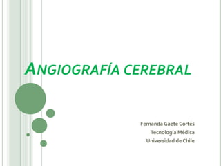 ANGIOGRAFÍA CEREBRAL
Fernanda Gaete Cortés
Tecnología Médica
Universidad de Chile
 