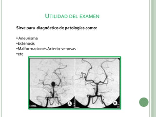 UTILIDAD DEL EXAMEN
Sirve para diagnóstico de patologías como:
•Aneurisma
•Estenosis
•MalformacionesArterio-venosas
•etc
 