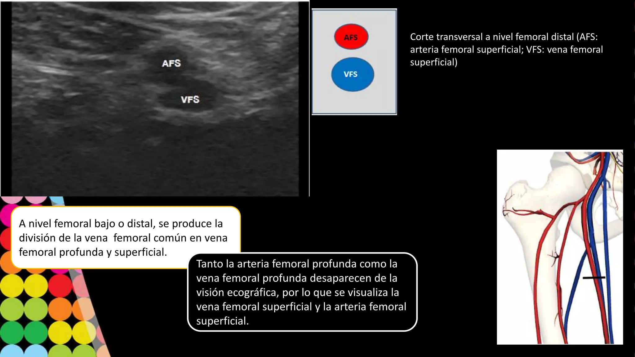 Angiografía y doppler de miembros inferiores | PPTX