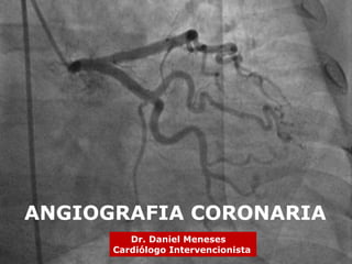 ANGIOGRAFIA CORONARIA
Dr. Daniel Meneses
Cardiólogo Intervencionista
 