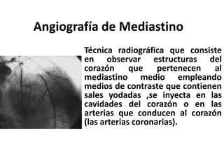 Técnica radiográfica que consiste
en observar estructuras del
corazón que pertenecen al
mediastino medio empleando
medios de contraste que contienen
sales yodadas ,se inyecta en las
cavidades del corazón o en las
arterias que conducen al corazón
(las arterias coronarias).
Angiografía de Mediastino
 
