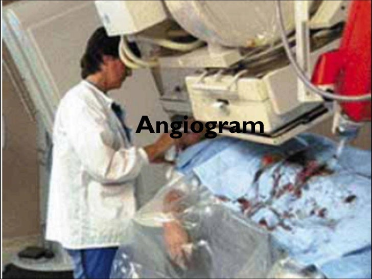 test heart health your Angiogram test heart health your Angiogram