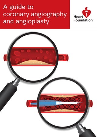 A guide to
coronary angiography
and angioplasty
 