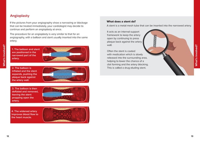 angiography-and-angioplasty-2018.pdf