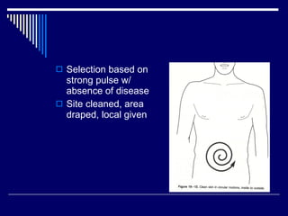 Selection based on strong pulse w/ absence of disease Site cleaned, area draped, local given 