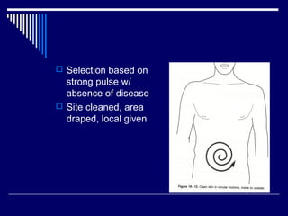  Selection based on
strong pulse w/
absence of disease
 Site cleaned, area
draped, local given
 