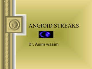 ANGIOID STREAKS Dr. Asim wasim 