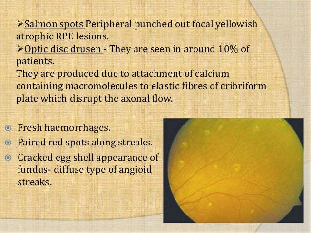12 Salmon Spots Peripheral 12 Salmon Spots Peripheral