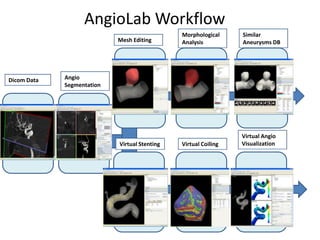 AngioLabWorkflow Similar Aneurysms DB MorphologicalAnalysis MeshEditing AngioSegmentation Dicom Data Virtual AngioVisualization Virtual Stenting Virtual Coiling 