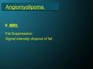 Angiomyolipoma
V. MRI:
Fat-Suppression:
Signal intensity dropout of fat .
 