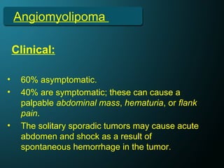 Angiomyolipoma
Clinical:
• 60% asymptomatic.
• 40% are symptomatic; these can cause a
palpable abdominal mass, hematuria, or flank
pain.
• The solitary sporadic tumors may cause acute
abdomen and shock as a result of
spontaneous hemorrhage in the tumor.
 