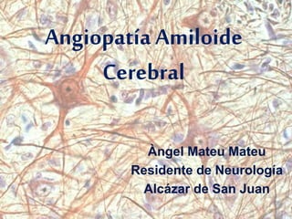 Angiopatía Amiloide
Cerebral
Àngel Mateu Mateu
Residente de Neurología
Alcázar de San Juan
 