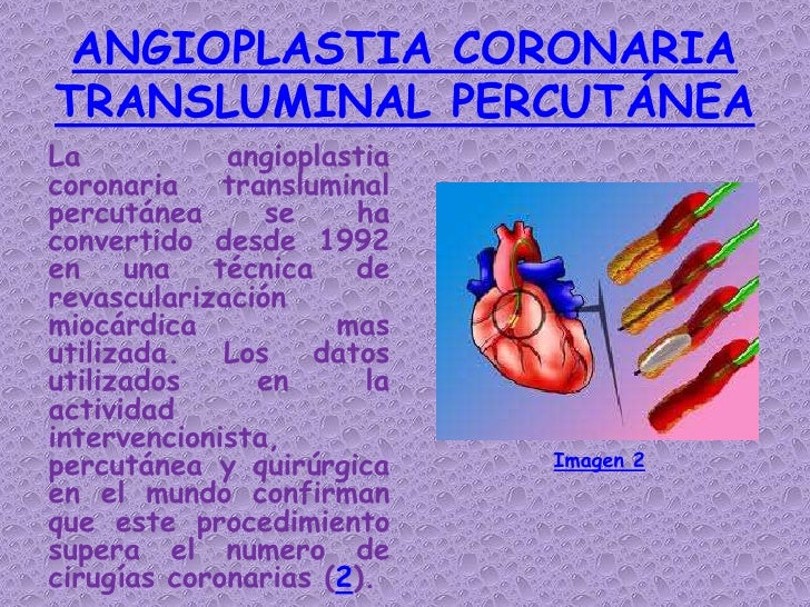 Angioplastia