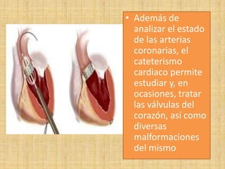 • Además de
analizar el estado
de las arterias
coronarias, el
cateterismo
cardiaco permite
estudiar y, en
ocasiones, tratar
las válvulas del
corazón, así como
diversas
malformaciones
del mismo

 