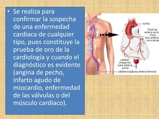 • Se realiza para
confirmar la sospecha
de una enfermedad
cardiaca de cualquier
tipo, pues constituye la
prueba de oro de la
cardiología y cuando el
diagnóstico es evidente
(angina de pecho,
infarto agudo de
miocardio, enfermedad
de las válvulas o del
músculo cardiaco).

 