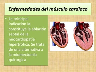 Enfermedades del músculo cardiaco
• La principal
indicación la
constituye la ablación
septal de la
miocardiopatía
hipertrófica. Se trata
de una alternativa a
la miomectomía
quirúrgica

 