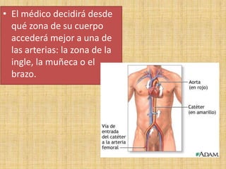 • El médico decidirá desde
qué zona de su cuerpo
accederá mejor a una de
las arterias: la zona de la
ingle, la muñeca o el
brazo.

 
