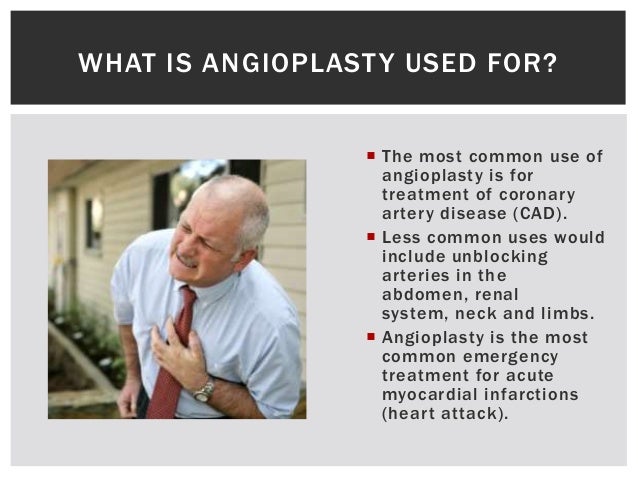 Angioplasty