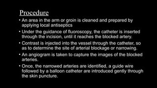 Angioplasty & Setenting procedures and prepaaration | PPTX