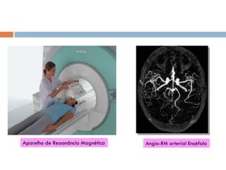 Angio-RM arterial EncéfaloAparelho de Ressonância Magnética
 