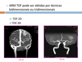  ARM TOF pode ser obtidas por técnicas
bidimensionais ou tridimensionais
 TOF-2D
 TOF-3D
TOF-2D TOF-3D
 