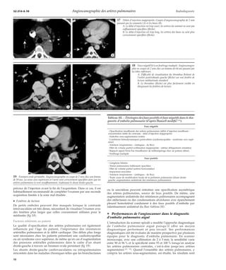 32-214-A-10 Angioscanographie des artères pulmonaires Radiodiagnostic 
*A *B 
*A *B 
précoce de l’injection avant la fin de l’acquisition. Dans ce cas, il est 
habituellement recommandé de compléter l’examen par une seconde 
acquisition limitée à la zone mal étudiée. 
· Fenêtres de lecture 
De petits emboles peuvent être masqués lorsque le contraste 
intravasculaire est très dense, nécessitant de visualiser l’examen avec 
des fenêtres plus larges que celles couramment utilisées pour le 
médiastin (fig 18). 
Facteurs inhérents au patient 
La qualité d’opacification des artères pulmonaires est également 
influencée par l’âge du patient, l’importance des résistances 
artérielles pulmonaires et le débit cardiaque. Des délais plus longs 
sont nécessaires chez les patients présentant une cardiomyopathie 
ou un syndrome cave supérieur, de même qu’en cas d’augmentation 
des pressions artérielles pulmonaires dans le cadre d’un shunt 
droite-gauche à travers un foramen ovale persistant (fig 19). 
Les shunts droite-gauche cardiovasculaires ou intrapulmonaires 
rencontrés dans les maladies chroniques telles que les bronchectasies 
17 Délais d’injection inappropriés. Coupes d’angioscanographie de 2 mm 
passant par les sommets (A) et les bases (B). 
A. Le délai d’injection est trop court, les artères du sommet ne sont pas 
suffisamment opacifiées (flèche). 
B. Le délai d’injection est trop long, les artères des bases ne sont plus 
correctement opacifiées (flèche). 
18 Faux négatif lié à un fenêtrage inadapté. Angioscanogra-phie 
en coupes de 2 mm chez un homme de 64 ans passant par 
les lobes inférieurs. 
A. Difficulté de visualisation du thrombus flottant de 
l’artère postérobasale gauche (flèche) sur une fenêtre de 
lecture médiastinale standard. 
B. Le thrombus (flèche) est plus facilement visible en 
élargissant les fenêtres de lecture. 
ou la sarcoïdose peuvent entraîner une opacification asymétrique 
des artères pulmonaires, source de faux positifs. De même, une 
augmentation unilatérale des résistances pulmonaires accompagnant 
des atélectasies ou des condensations alvéolaires avec épanchement 
pleural homolatéral conduisent à des faux positifs d’embolie par 
ralentissement unilatéral du flux (tableau III). 
¦ Performances de l’angioscanner dans le diagnostic 
d’embolie pulmonaire aiguë 
L’introduction du scanner spiralé a modifié l’approche diagnostique 
de l’embolie pulmonaire aiguë puisqu’il offre un moyen 
diagnostique performant et peu invasif. Ses performances 
diagnostiques ont été évaluées de manière prospective par plusieurs 
équipes pour le diagnostic d’embolie pulmonaire. En scanner 
monocoupe, avec une collimation de 2 à 3mm, la sensibilité varie 
entre 90 et 96 % et la spécificité entre 93 et 100 % lorsqu’on analyse 
les artères pulmonaires centrales, c’est-à-dire jusqu’aux artères 
segmentaires [27, 35]. Quand l’ensemble des artères pulmonaires, y 
compris les artères sous-segmentaires, est étudié, les résultats sont 
19 Foramen ovale perméable. Angioscanographie en coupe de 2 mm chez une femme 
de 59 ans. La veine cave supérieure et l’aorte sont correctement opacifiées alors que les 
artères pulmonaires le sont insuffisamment, traduisant le shunt droite-gauche. 
Tableau III. – Étiologies des faux positifs et faux négatifs dans le dia-gnostic 
d’embolie pulmonaire (d’après Hansell modifié [15]). 
Faux négatifs 
- Opacification insuffisante des artères pulmonaires (débit d’injection insuffisant - 
concentration faible de contraste - délai d’injection inapproprié) 
- Embolies sous-segmentaires isolées 
- Conditions hémodynamiques particulières (cardiomyopathie - syndrome cave supé-rieur) 
- Artefacts (respiratoires - cinétiques - de flux) 
- Effet de volume partiel (collimation inappropriée - artères obliquement orientées) 
- Rapport signal/bruit bas (insuffisance de milliampérage chez un patient obèse) 
- Fenêtrage inadapté 
Faux positifs 
- Ganglions hilaires 
- Veines pulmonaires faiblement opacifiées 
- Effet de volume partiel (artères horizontales) 
- Impactions mucoïdes 
- Artefacts (respiratoires - cinétiques - de flux) 
- Toute cause de modification focale de la perfusion pulmonaire (shunt droite-gauche, 
augmentation unilatérale des résistances pulmonaires) 
10 
 
