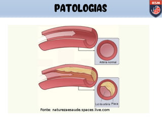 PATOLOGIAS
 