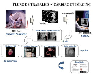 FLUXO DE TRABALHO - CARDIAC CT IMAGING
ECG- Scan
Imagem SnapShot
Recon
Pós processo
CardIQ
Auto transfer
Resultado
ReformataçãoAnálise de vaso 3D Coronárias3D Heart VR
3D Quick View
MulF-Phase rfmt Reviewer
~2 min
Function
 