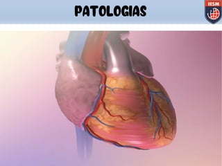 PATOLOGIAS
 